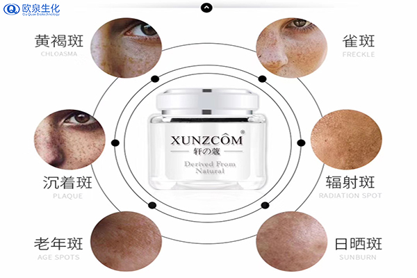 祛斑代加工:如何預防色斑的產生-歐泉生化
